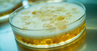 Petri dish with bacterial colonies under laboratory lighting on sterile white surface.