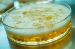 Petri dish with bacterial colonies under laboratory lighting on sterile white surface.