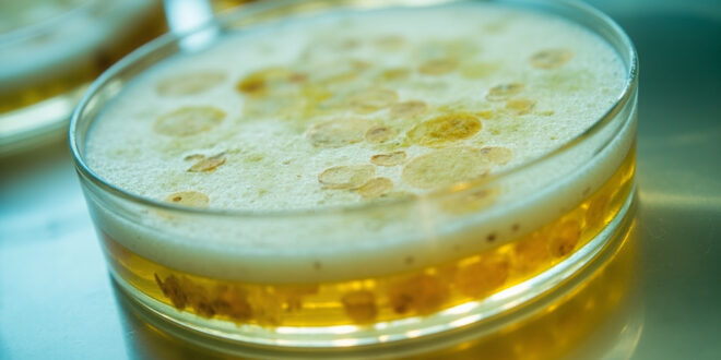 Petri dish with bacterial colonies under laboratory lighting on sterile white surface.